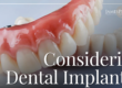 Dental Implants