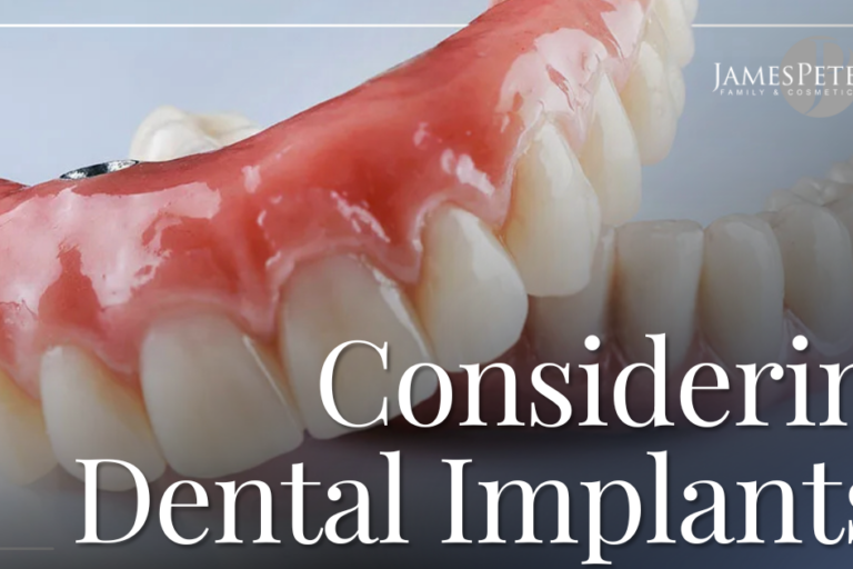 Dental Implants