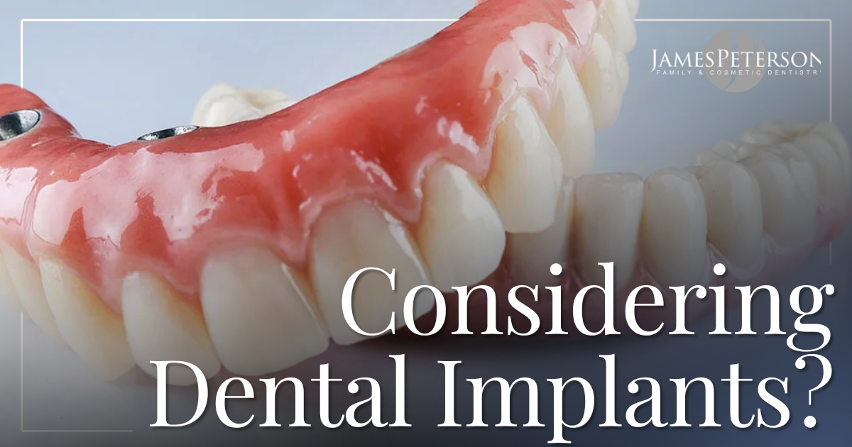 Considering Dental Implants? Dental Implants