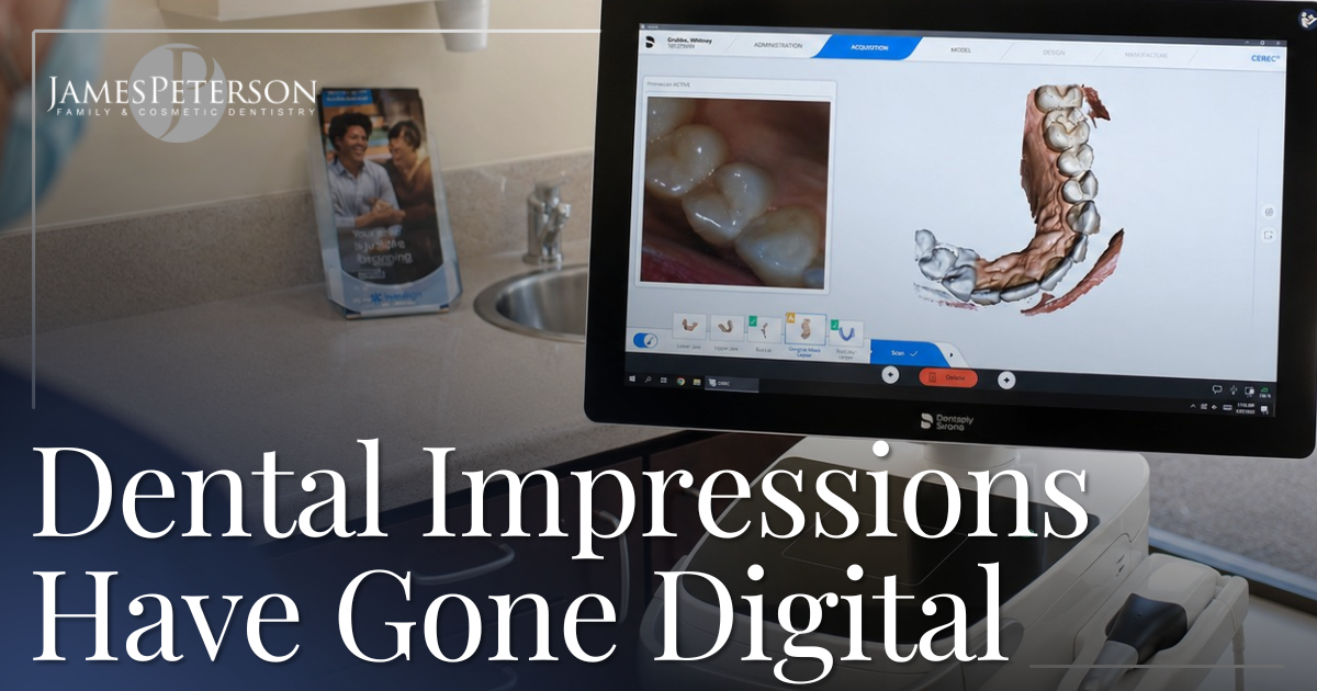 Dental Impressions Have Gone Digital digital scans